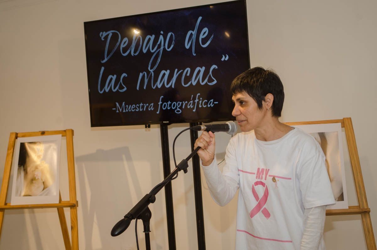 Exhiben la muestra fotográfica “Debajo de las Marcas”, representando la lucha contra el cáncer de mamas